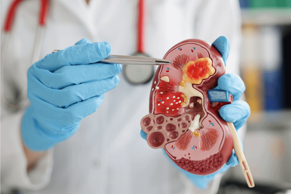 nephrologist in siliguri